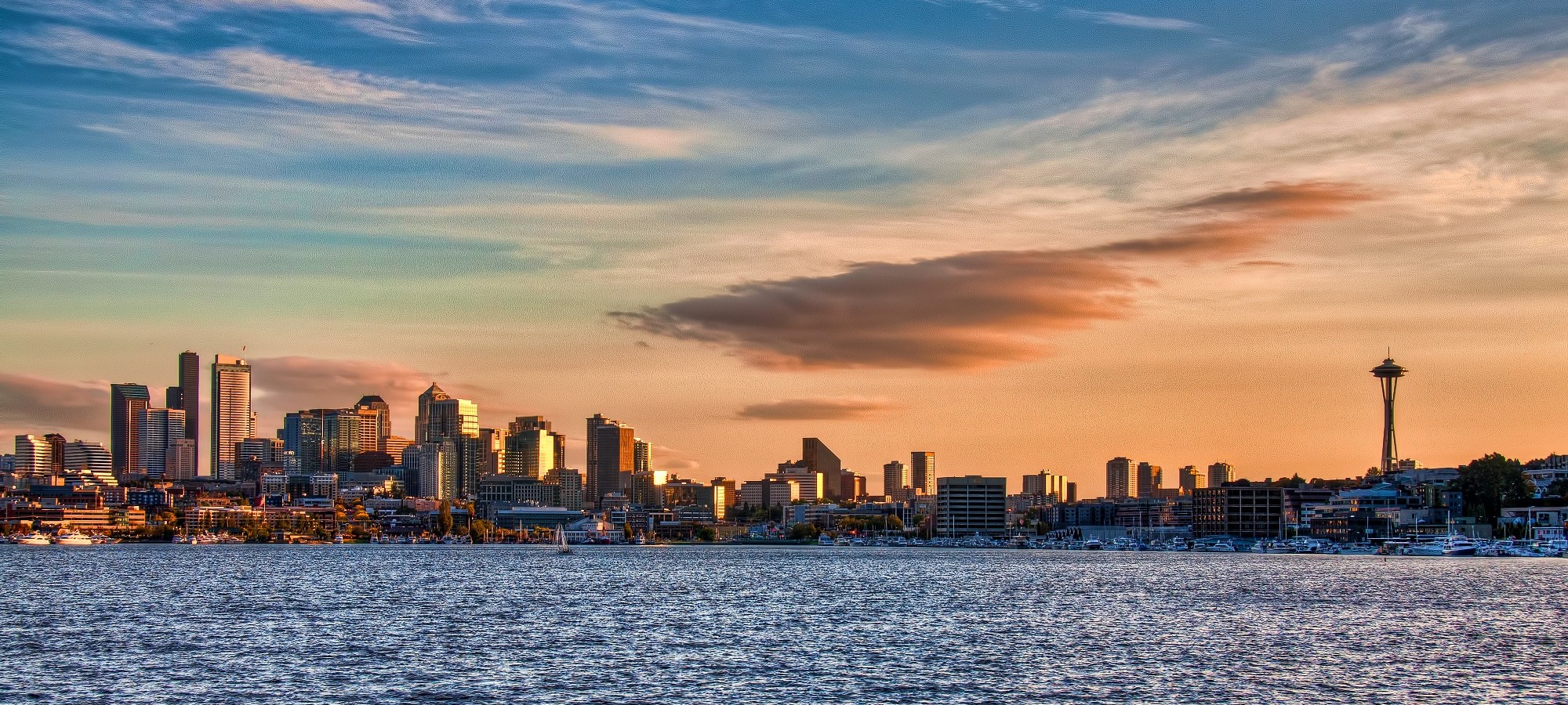 Endodontics Seattle WA, Endodontist